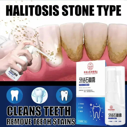 Dental Calculus Remover Teeth Whitening Spray Toothpaste Cleaning Oral Hygiene Removal Halitosis Plaque Stains Fresh Breath Care