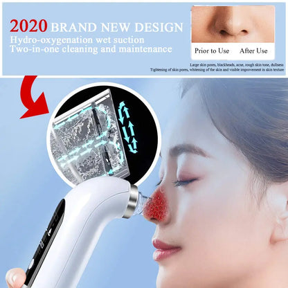 Black Head Remover USB Charger Strong Blackhead Vacuum Suction Remover Cleanser Facial Pores Cleaner